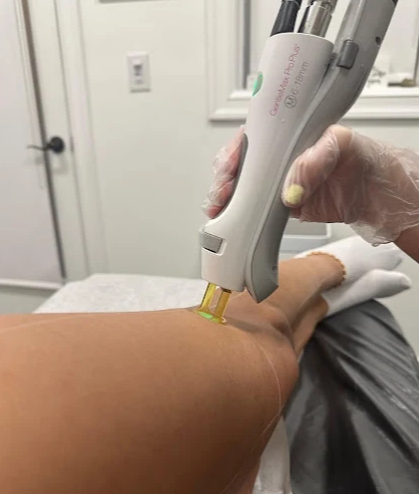 Professional laser hair removal and body contouring services in Pembroke Pines FL